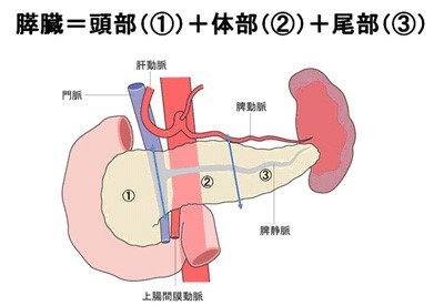 良性 膵臓 腫瘍