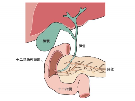 胆石 痛み 緩和