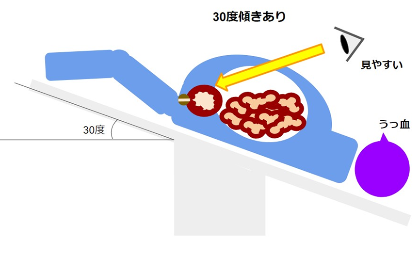 手術後は何をすればよいですか?